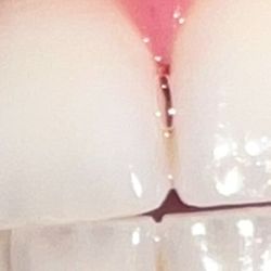 CanAm Dental