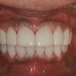 Bakersfield Smile Design: Dr. Kenneth W Krauss