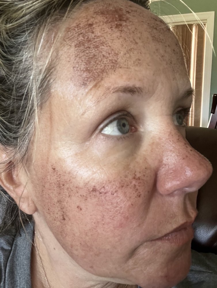 DERMATOLOGY ASSOCIATES OF SOUTH MS Updated April 2024 2550 Pass Rd