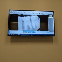 Wildwood Dental - Super Hi-Tech!! You see your x-ray image immediately.