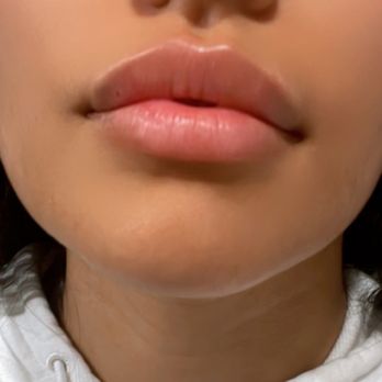 Pur Bliss Med spa - Medical Spas Near Me - St. Charles, Illinois