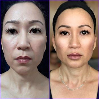 Cynthia Lopez, MD - Cosmetic Surgeons Near Me - Fresno, California Cynthia Lopez, MD - Cosmetic Surgeons Near Me - Fresno, California