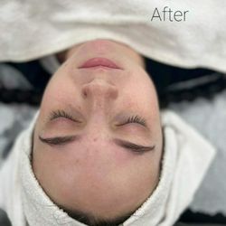 D' Beauty Beastt - After facial