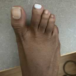 This happened less than a week after I got them done, simply unacceptable. This happened less than a week after I got them done, simply unacceptable.