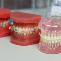 OrthoMike Orthodontics - We offer Invisalign, Clear Braces, and Metal Braces in our Boca Raton office.
