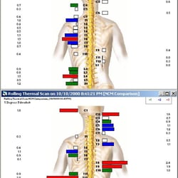 The Harte of Chiropractic - Here, you get neurological scans to SEE the physiology... function... of your nervous system. Essential in analyzing VSC