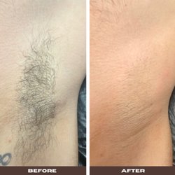Smooth Criminal - Underarm waxing