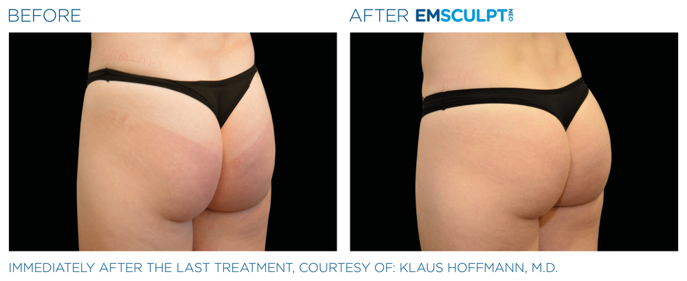 Mill Creek Skin & Laser Coolsculpting Center Logo