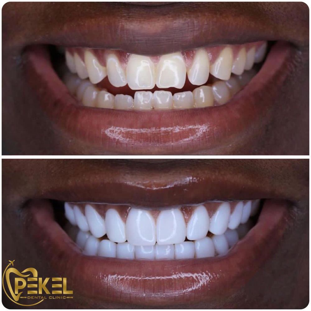 PEKEL DENTAL CLINIC ANTALYA 16 Photos Kızılsaray, Yener Ulusoy Blv