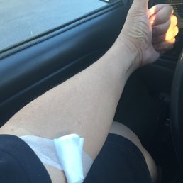 Rima and Ray had no problem finding my "disappearing veins"! Rima and Ray had no problem finding my "disappearing veins"!