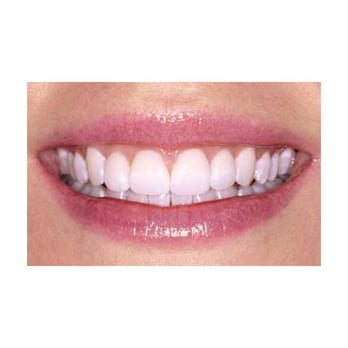 Brisbane Smiles - General Dentistry Near Me - Toowong, QLD Brisbane Smiles - General Dentistry Near Me - Toowong, QLD