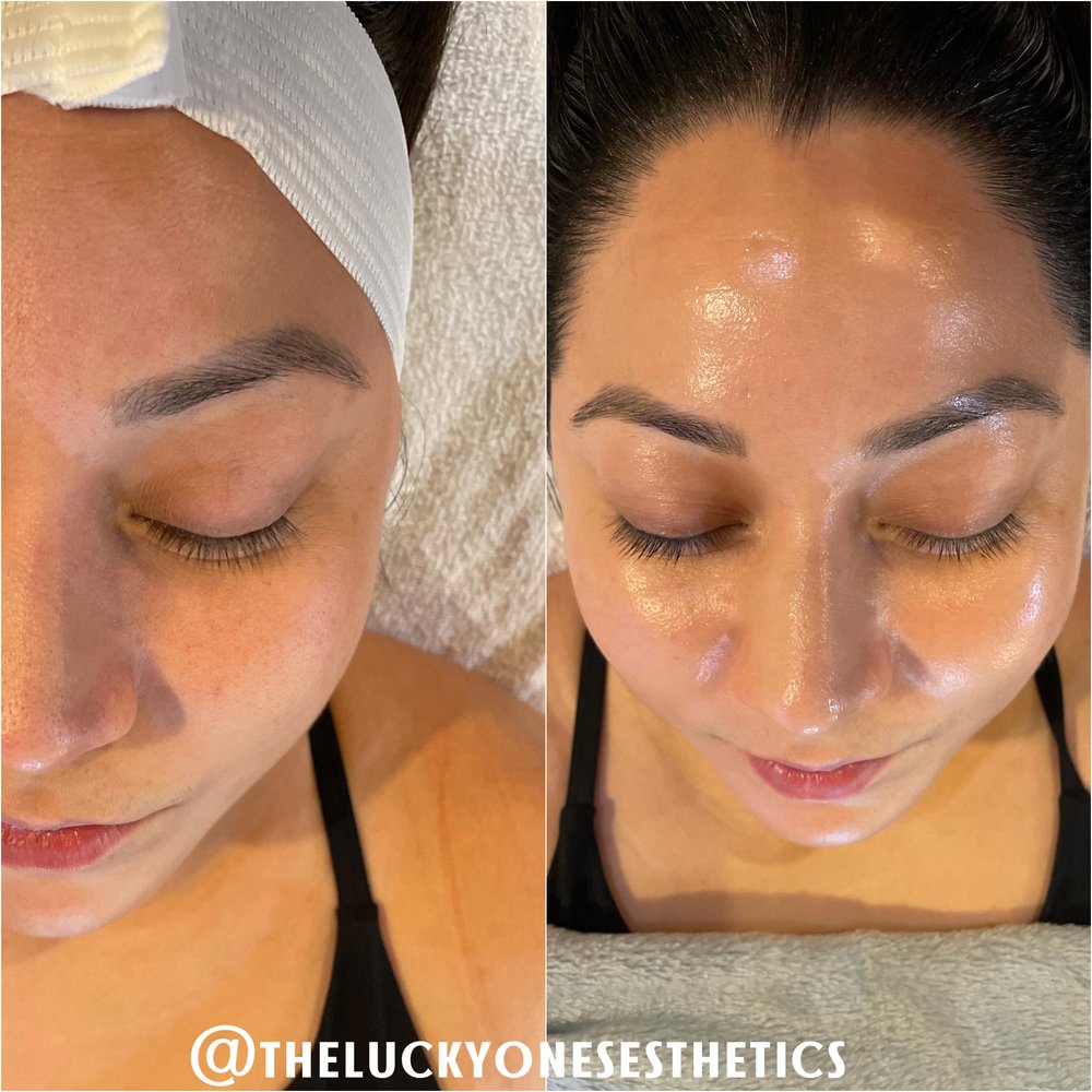 The Lucky Ones Esthetics Logo