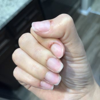 Luxy Nails - Nail beds are swollen and scabbing over - Nail Salons Near Me - Atlanta, Georgia