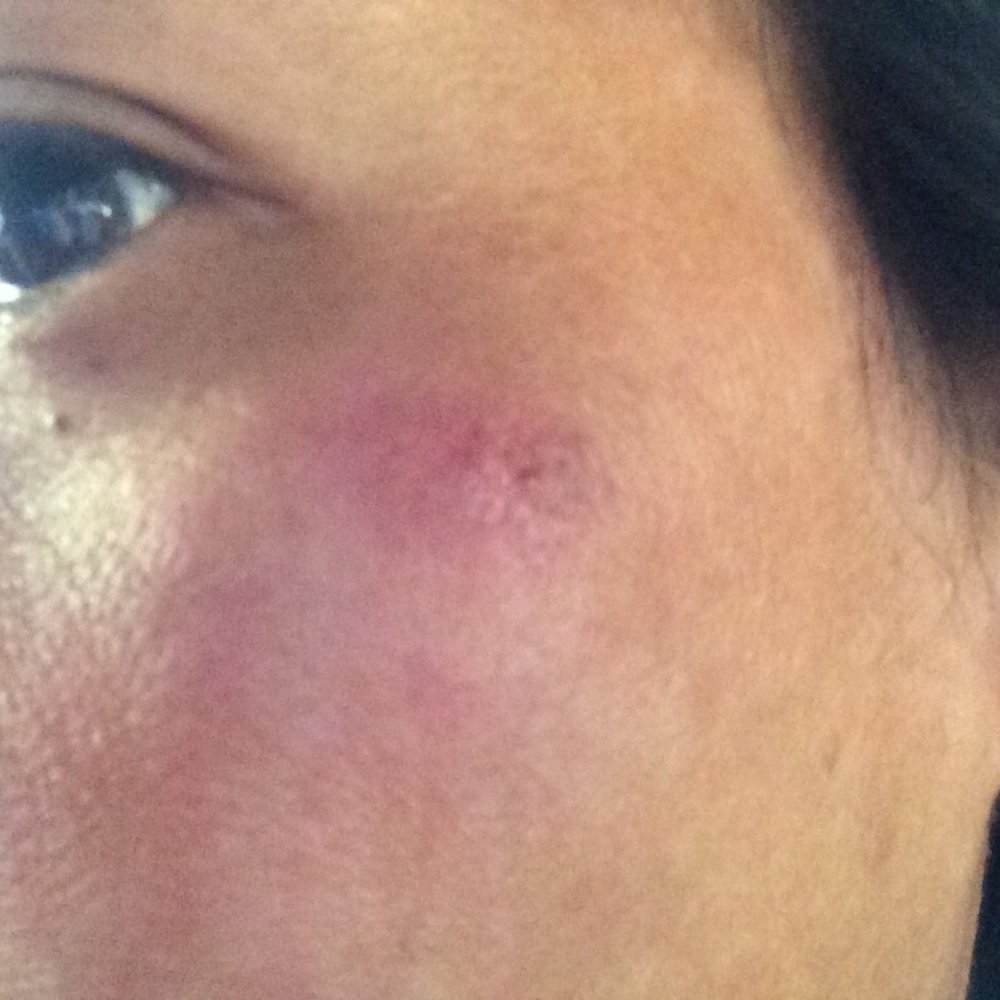 Sense Salon - Here's the burn the blonde Asian girl gave me to show and explain to all my relatives at my brother's funeral. - Hair Salons Near Me - Vallejo, California Sense Salon - Here's the burn the blonde Asian girl gave me to show and explain to all my relatives at my brother's funeral. - Hair Salons Near Me - Vallejo, California