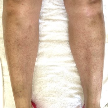 Rooted Skin By Ang - After leg wax - Waxing Near Me Rooted Skin By Ang - After leg wax - Waxing Near Me