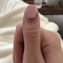 Skin all along nail line cut, bled the entire appointment. Worried about a possible infection. Skin all along nail line cut, bled the entire appointment. Worried about a possible infection.
