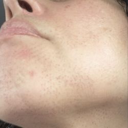 Bottom side face