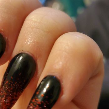 Lee Nails and Spa - Irritated skin - Nail Salons Near Me - Estero, Florida Lee Nails and Spa - Irritated skin - Nail Salons Near Me - Estero, Florida