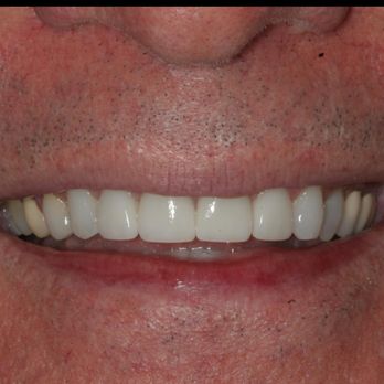 Marcos Ortega, DDS - General Dentistry Near Me - San Diego, California Marcos Ortega, DDS - General Dentistry Near Me - San Diego, California