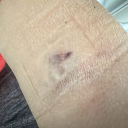Gulf Coast Blood - Horrible pain