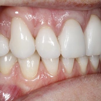 Scott Schwartz, DDS - Bright beautiful smile! - General Dentistry Near Me - Croton on Hudson, New York Scott Schwartz, DDS - Bright beautiful smile! - General Dentistry Near Me - Croton on Hudson, New York