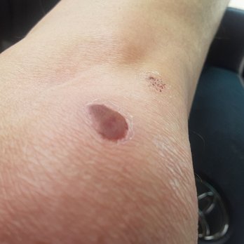 Public Storage - That's my knee from the fall. - Self Storage Near Me - Gardena, California