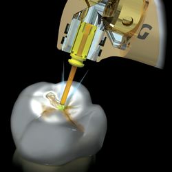 Omega Dental Care - Laser Dentistry is minimally invasive dentistry