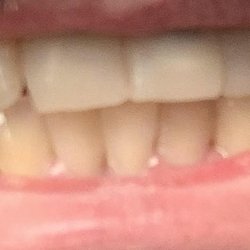 Connerton Dental Care - After