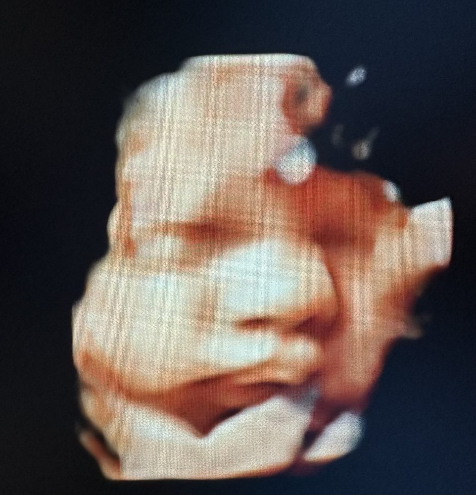 EXPECTANT BLESSINGS Updated July 2024 550 Oak St, Forest City