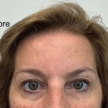 Microblading Artistry Premier Studio - Going into the procedure.  You can see how thin the brows are. - Permanent Makeup Near Me - Sugar Hill, Georgia