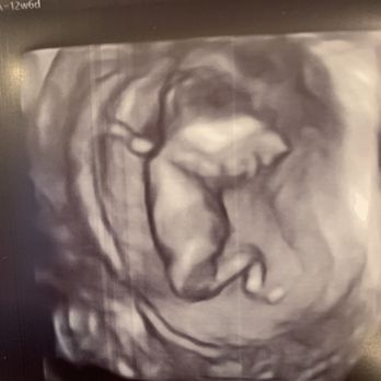 Unique Ultrasound - Baby Ultrasound - Diagnostic Imaging Near Me - Temecula, California Unique Ultrasound - Baby Ultrasound - Diagnostic Imaging Near Me - Temecula, California