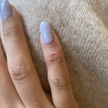 Castle Nail Bar - Skin outbreak right after the appointment - prob from the solution/their machine - Nail Salons Near Me - Bellevue, Washington Castle Nail Bar - Skin outbreak right after the appointment - prob from the solution/their machine - Nail Salons Near Me - Bellevue, Washington