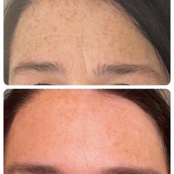 Mystic Moon Aesthetics - Medical Spas Near Me - Pensacola, Florida Mystic Moon Aesthetics - Medical Spas Near Me - Pensacola, Florida