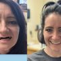 Smile Prosthetics