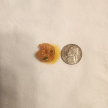 Via Vecchia - Shrimp is smaller that a nickel! - Italian Near Me - Portland, Maine