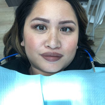 Oakmont Endodontics - About to go to have root canal - Endodontists Near Me - Glendale, California