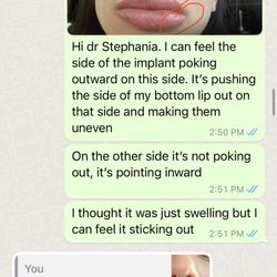 Elite Plastic Surgeon - Proof that Dr. Stephania was lying from the very beginning.