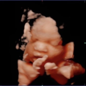 Austin Imaging and Lab - 4D ultrasound - Ultrasound Imaging Centers Near Me - Austin, Texas Austin Imaging and Lab - 4D ultrasound - Ultrasound Imaging Centers Near Me - Austin, Texas