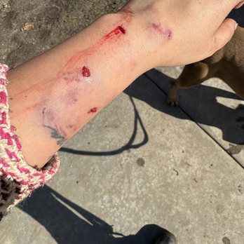 Redlands Dog Park - my wound in the midst of the dog fight - Dog Parks Near Me - Redlands, California