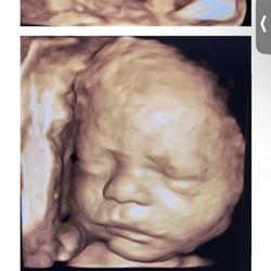 Prenatal Peek - 3D/4D Ultrasound - This is what I paid for , this is there example on there website