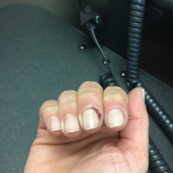 Stellar Nails - Picture of my cuticle that they cut during my manicure :( - Nail Salons Near Me - Overland Park, Kansas