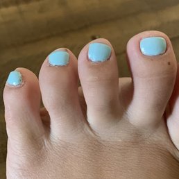 The direction of my middle pinky toe nail is now a different one than my toe. The direction of my middle pinky toe nail is now a different one than my toe.