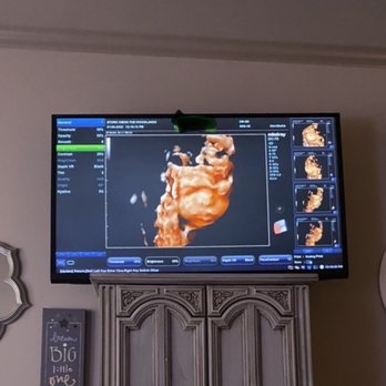 Stork Vision - Ultrasound - Diagnostic Imaging Near Me - Shenandoah, Texas Stork Vision - Ultrasound - Diagnostic Imaging Near Me - Shenandoah, Texas