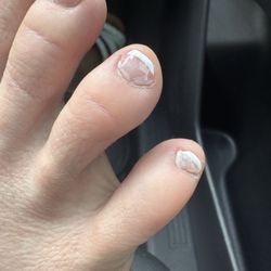Messed up gel pedicure