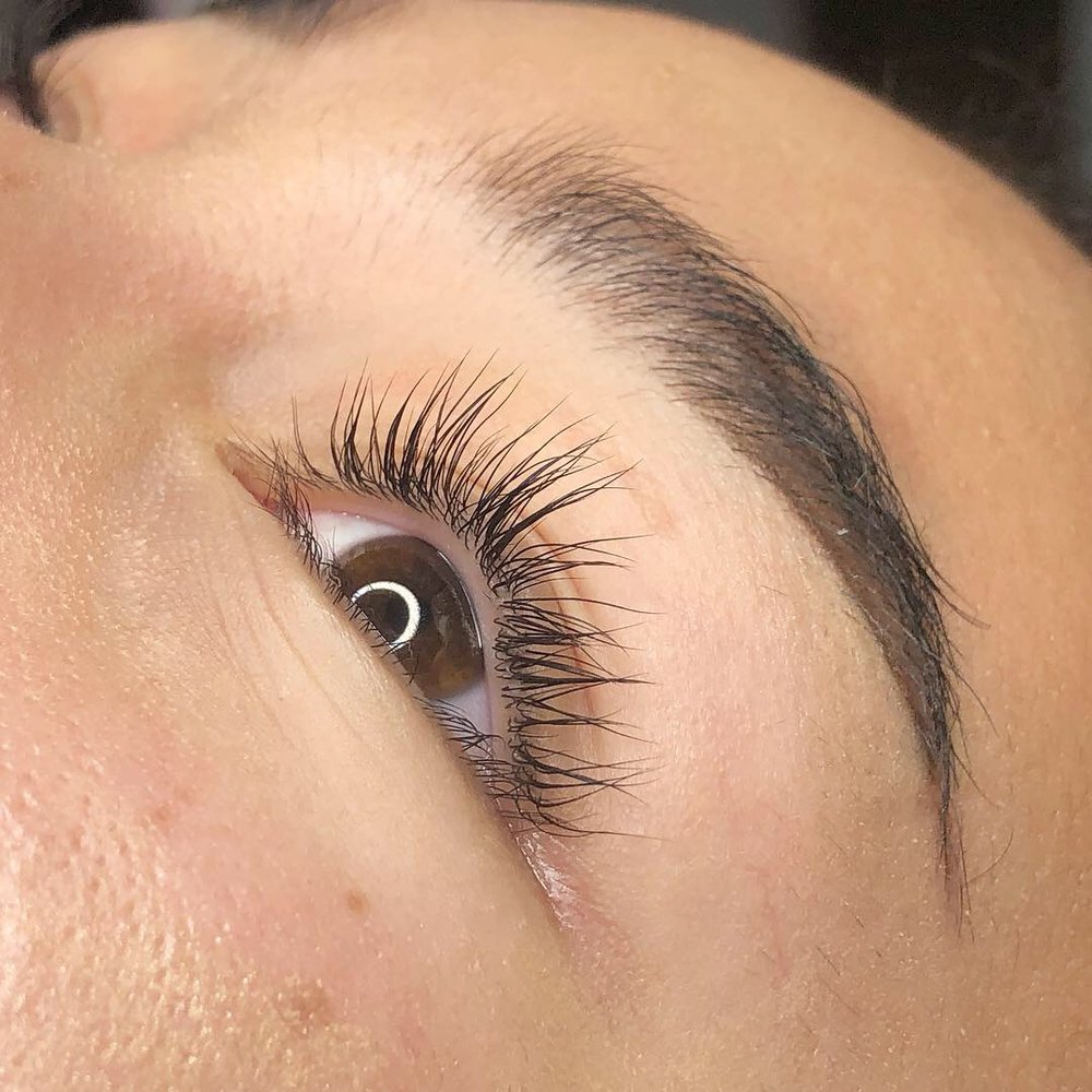 ALLURE AESTHETICS Request an Appointment 21 Photos 29229 Central