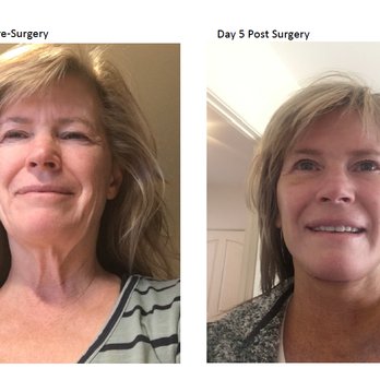 Keller Plastic Surgery - Medical Spas Near Me - Santa Barbara, California Keller Plastic Surgery - Medical Spas Near Me - Santa Barbara, California