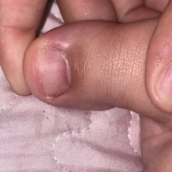 Painful mark done my drill
