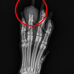 Colonial Park Animal Clinic - This is the x-ray taken of his paw showing the bone that had deteriorated!