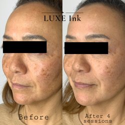 LUXE Ink - JET plasma treatment