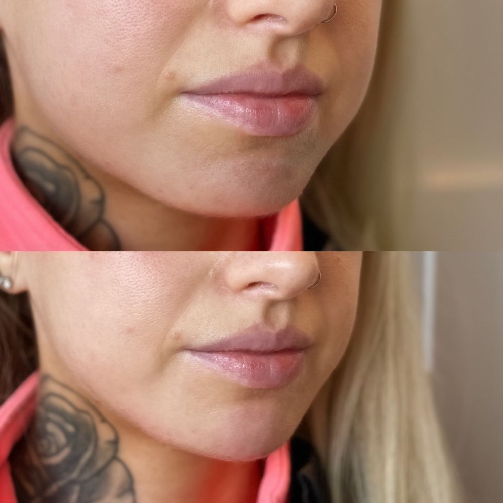 lift-aesthetics-updated-october-2024-request-an-appointment-820